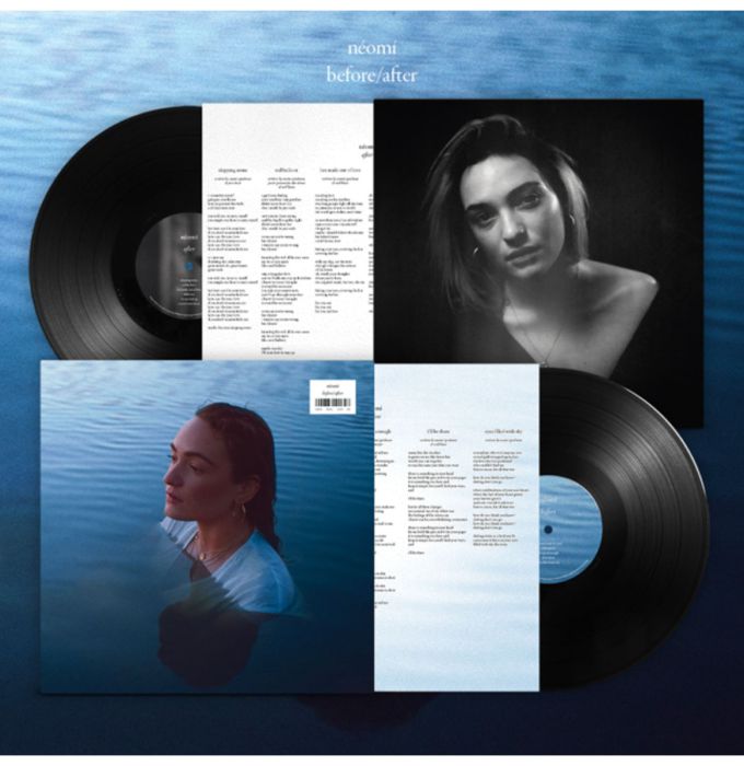 NEOMI - BEFORE/AFTER