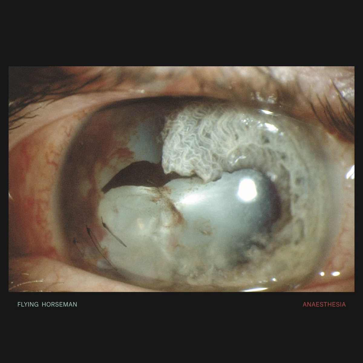 FLYING HORSEMAN - ANAESTHESIA